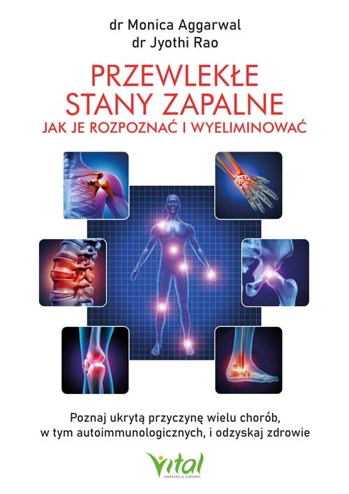 459-przewlekle-stany-zapalne.jpg
