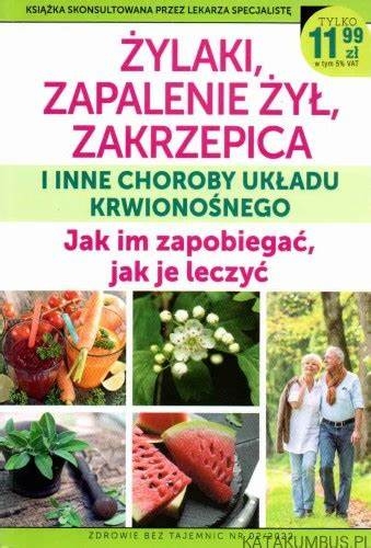 ŻYLAKI ZAPALENIE ŻYŁ ZAKRZEPICA I INNE CHOROBY UKŁADU KRWIONOŚNEGO