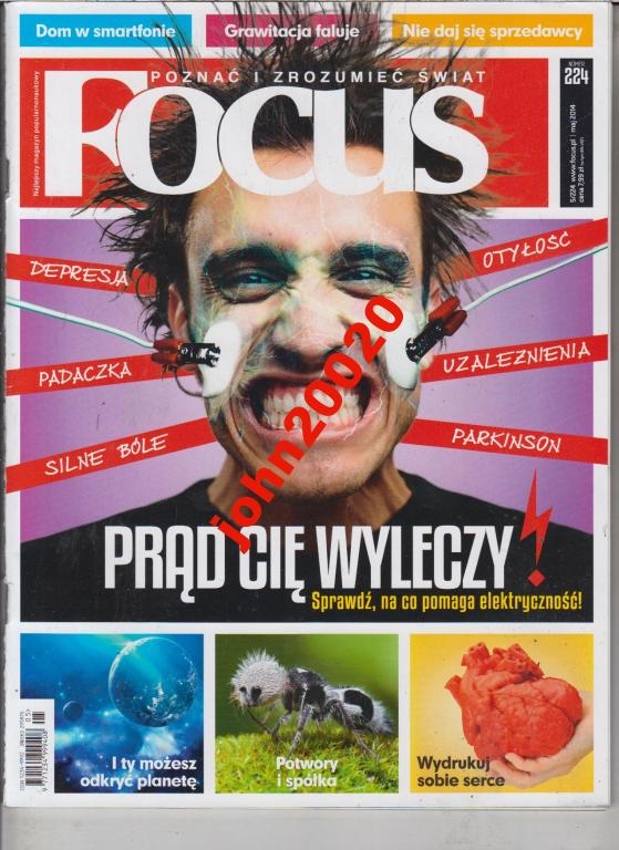 5/2014 FOCUS,LECZENIE PRĄDEM