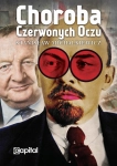 CHOROBA CZERWONYCH OCZU STANISŁAW MICHALKIEWICZ