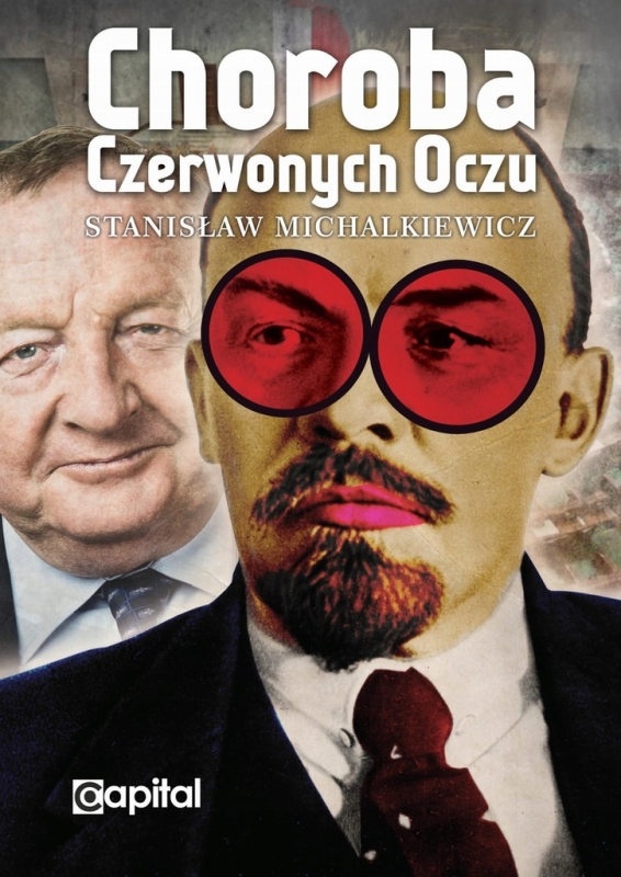 CHOROBA CZERWONYCH OCZU STANISŁAW MICHALKIEWICZ