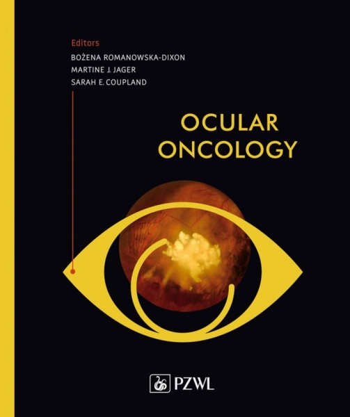 OCULAR ONCOLOGY BOŻENA ROMANOWSKA-DIXON 