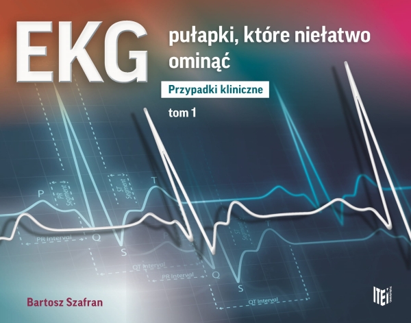 EKG PUŁAPKI KTÓRE NIEŁATWO OMINĄĆ B SZAFRAN 