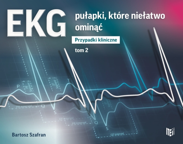 EKG PUŁAPKI KTÓRE NIEŁATWO OMINĄĆ B SZAFRAN TOM 2 