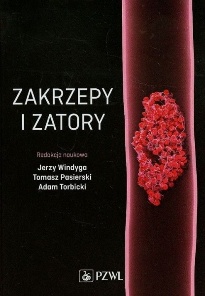   ZAKRZEPY I ZATORY J WINDAGA T PASIERSKI A TORBICKI  