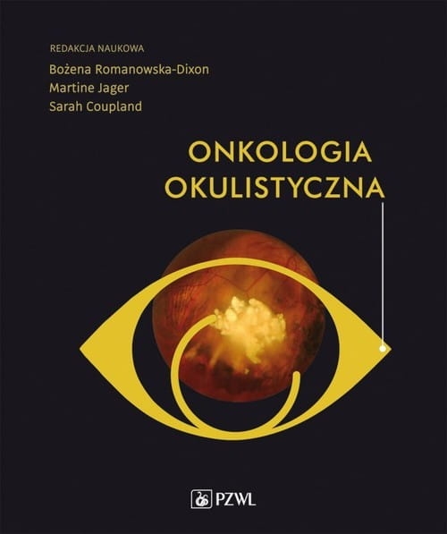ONKOLOGIA OKULISTYCZNA B ROMANOWSKA DIXON 