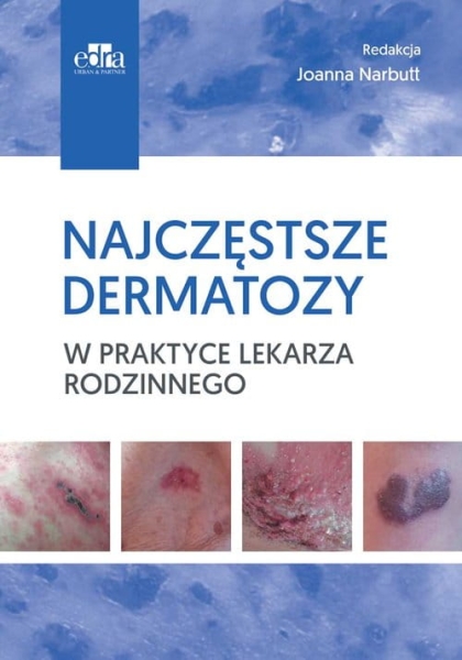 NAJCZĘSTSZE DERMATOZY W PRAKTYCE LEKARZA RODZINNEGO