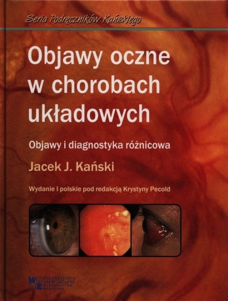  OBJAWY OCZNE W CHOROBACH UKŁADOWYCH J KAŃSKI