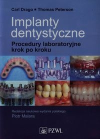 IMPLANTY DENTYSTYCZNE C DRAGO T PETERSON   