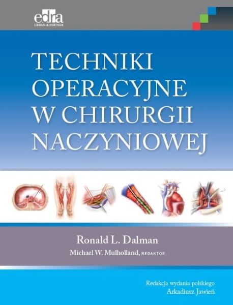 TECHNIKI OPERACYJNE W CHIRURGII NACZYNIOWEJ DALMAN