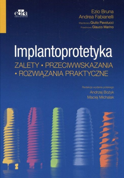 ef1-implantoprotetyka-zalety.jpg