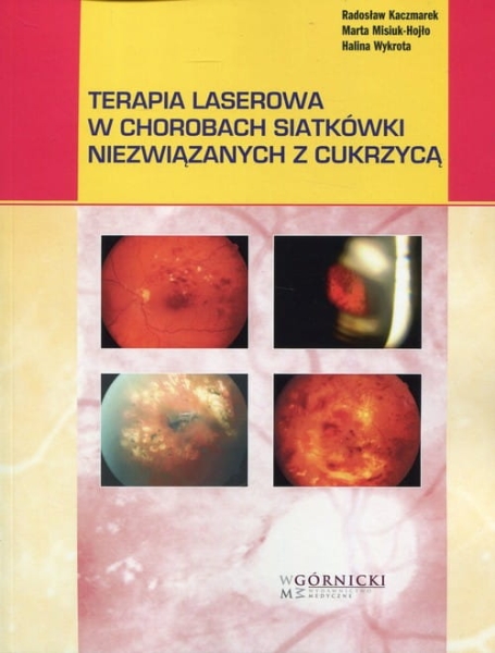 TERAPIA LASEROWA W CHOROBACH SIATKÓWKI KACZMAREK
