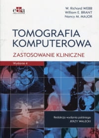 8e-tomografia-komputerowa-za_200.jpg