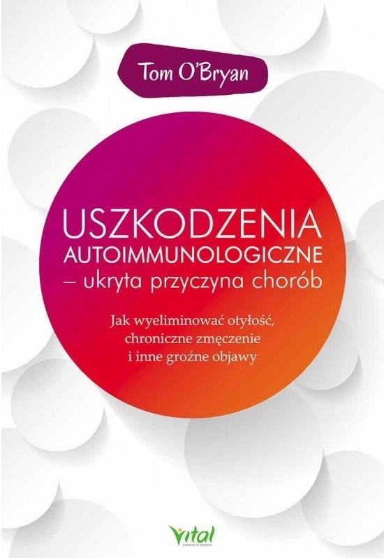 543d4bd-uszkodzenia-autoimmu.jpg