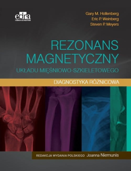 REZONANS MAGNETYCZNY UKŁADU MIĘŚNIOWO-SZKIELETOWEGO DIAGNOSTYKA RÓŻNICOWA