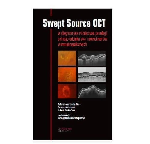 264e228c3a5-swept-source-oct.jpg