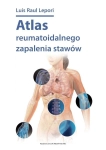 ATLAS REUMATOIDALNEGO ZAPALENIA STAWÓW LEPORI