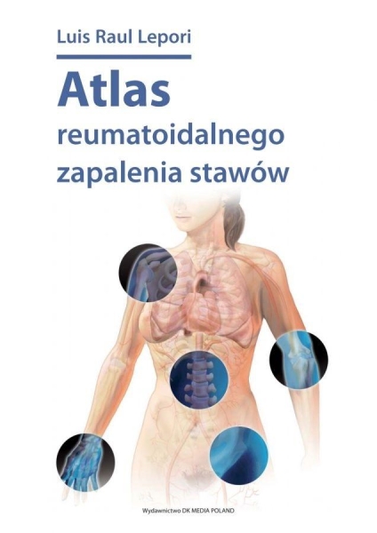 ATLAS REUMATOIDALNEGO ZAPALENIA STAWÓW LEPORI