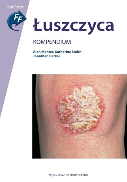 ŁUSZCZYCA KOMPENDIUM MENTER BARKER SMITH