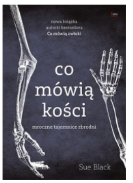 CO MÓWIĄ KOŚCI SUE BLACK 